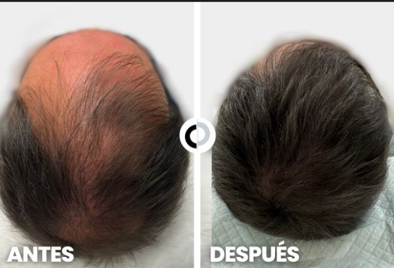 Shampoo Anti-Caída con Biotina 1% | Cabello Más Fuerte Desde la Raíz