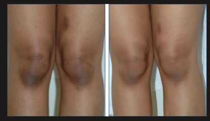 Crema Carotone/ Ayuda a mejorar la apariencia de manchas y zonas oscuras de tu piel, con envío gratis