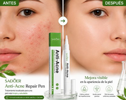 Gel Lapiz Antiacné SADOER/Despídete del Acné y Recupera una Piel Radiante con envío gratis🎁