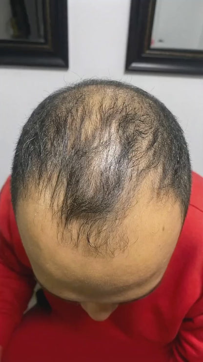 ¿Notas más cabello en tu almohada, peine o ducha?